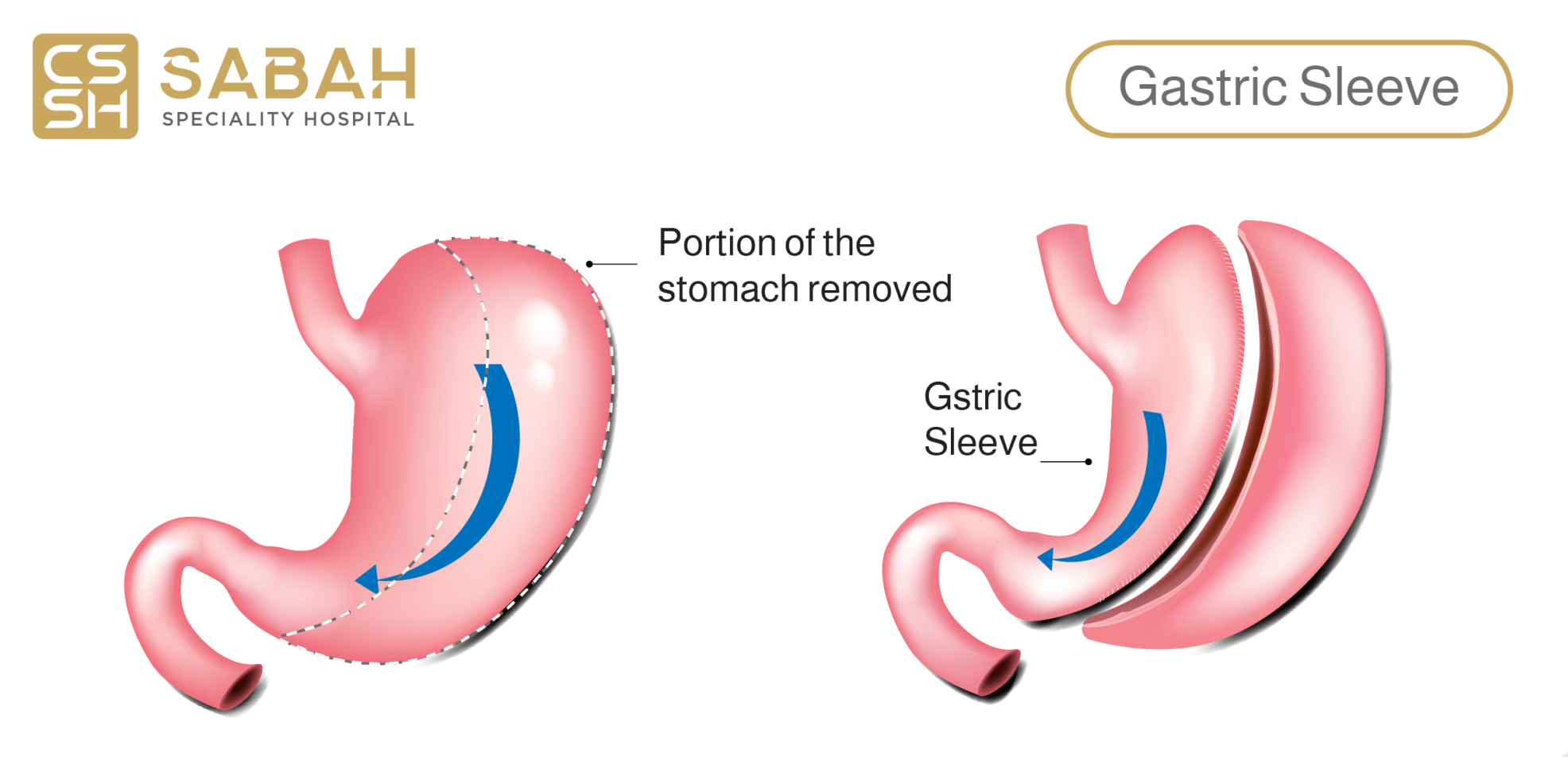 Gastics 01 2048x1090 1 e1716639172332