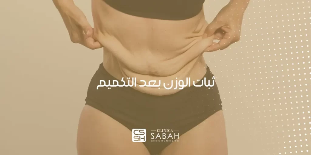 ثبات الوزن بعد ٦ شهور من التكميم