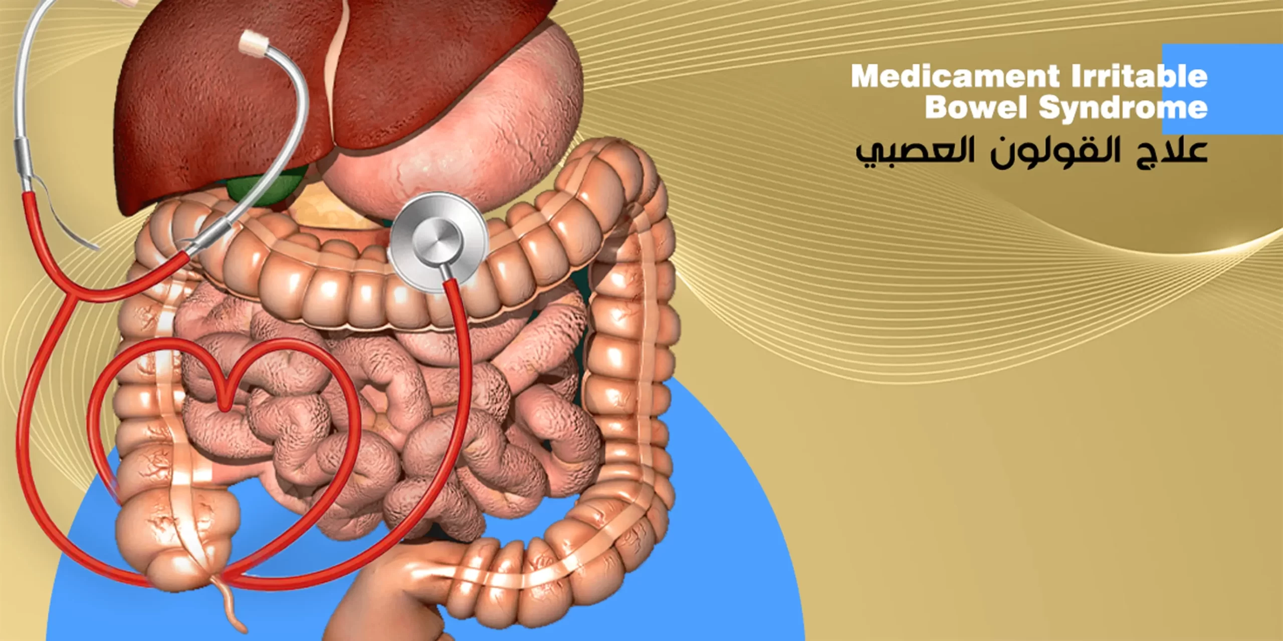 علاج القولون العصبي